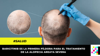 FDA aprobó la primera pastilla para combatir la alopecia