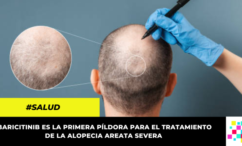 FDA aprobó la primera pastilla para combatir la alopecia