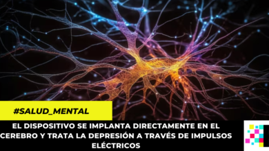 Desarrollan implante cerebral para curar la ansiedad