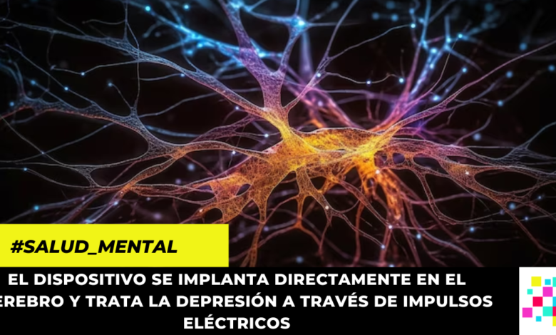 Desarrollan implante cerebral para curar la ansiedad