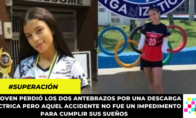 Conozca la historia de la modelo y deportista que quiere tener brazos biónicos para continuar con su carrera deportiva