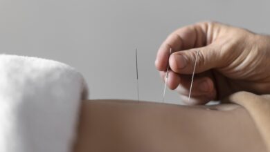 Descubre los beneficios de la acupuntura para la salud